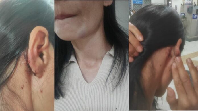 Juvenile apprehended in Saket racial assault case; raids underway to nab others