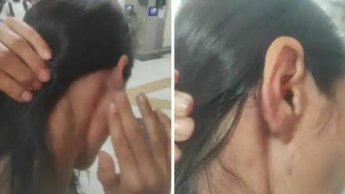 NHRC Issues Notice to Delhi Police Over Alleged Assault on Manipur Woman