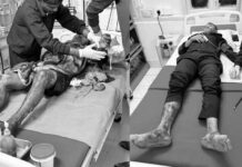 Grenade Attack on Assam Police Commando Camp in Tinsukia Leaves Four Injured Grenade Attack on Assam Police Commando Camp in Tinsukia Leaves Four Injured