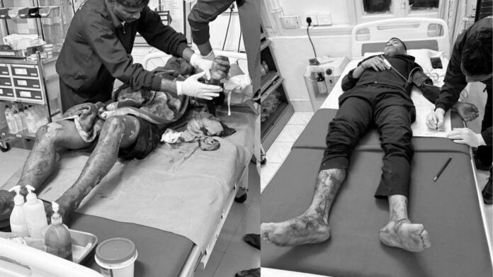 Grenade Attack on Assam Police Commando Camp in Tinsukia Leaves Four Injured