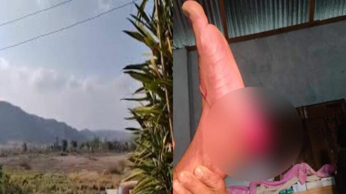 Man Injured in Firing Incident in Manipur Village Amid Ongoing Tensions