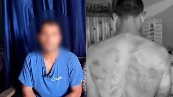 Man Alleges Abduction and Assault in Manipur Amid Continuing Ethnic Tensions