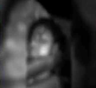 Youth Killed, Teen Girl Critically Injured in Late-Night Attack in Assam’s Nalbari
