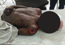 Mutilated Body of Youth Found in Nagaon, Murder Suspected Mutilated Body of Youth Found in Nagaon, Murder Suspected