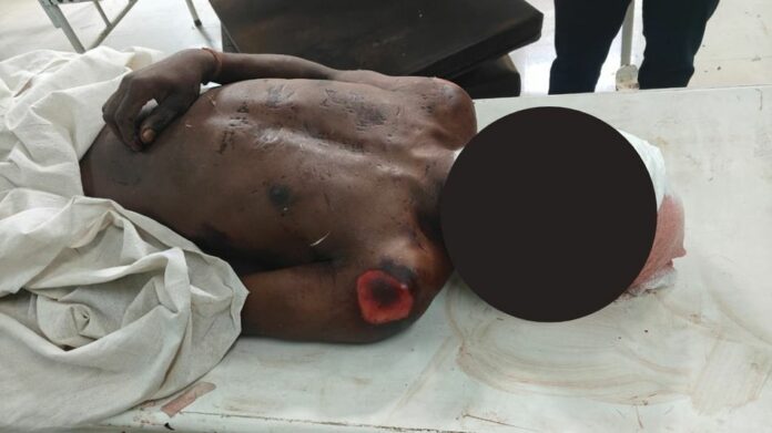 Mutilated Body of Youth Found in Nagaon, Murder Suspected