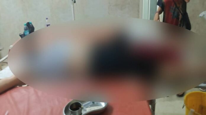 Woman Suffers Bullet Injury in Arunachal’s Namsai, Police Launch Probe