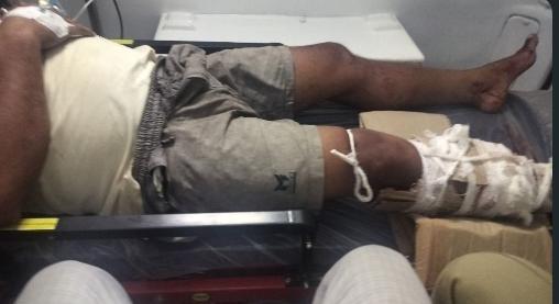 Robber Injured in Police Encounter in Assam’s Bongaigaon