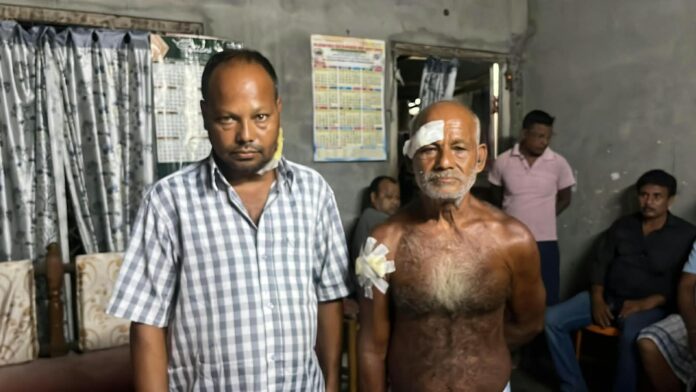 Land Dispute Leads to Clash, Father and Son Injured in Bamundi